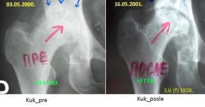BEHANDLUNG VON KNOCHEN UND VERBINDUNGEN