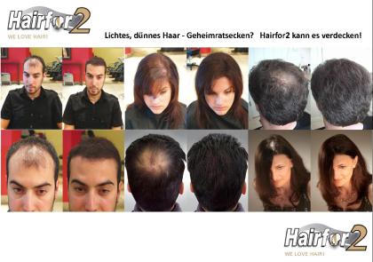Lichtes Haar? Dünnes Haar? Haarprobleme? Haarverlust? Haarausfall? Alopezie? Hai