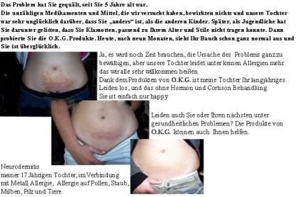 Sie leiden unter Übergewicht, Allergien, Exzemen oder unter anderen gesundheitli