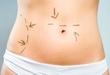 Schönheitsklinik/Ästhetisch-plastiche Chirurgie in Stettin, 100% Leistung - 60% 