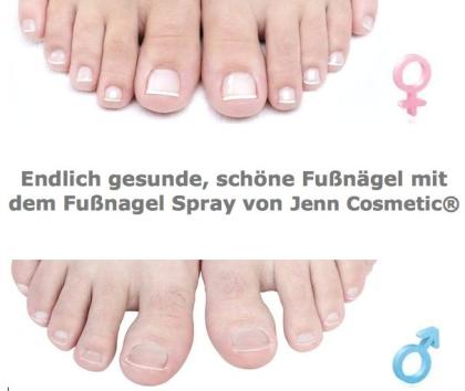 Gelbe Fußnägel? Fußnagel Spray von Jenn Cosmetic.