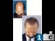 Haartransplantation 500 grafts 1000 euro