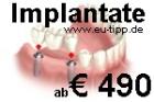 ZAHN-Behandlung CZ -günstiger als Ungarn- Implantate 490 €