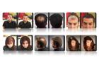 Haarverdichtung  Haarauffüllung mit HAIRFOR2  Hollywoods bestgehütetes Geheimnis
