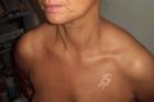 Airbrushtanning / Bräunung ohne UV-Strahlung