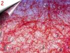 Laser Lace - Nagel Netz um 2, 40€