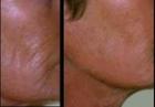 SudeShi Anti Aging